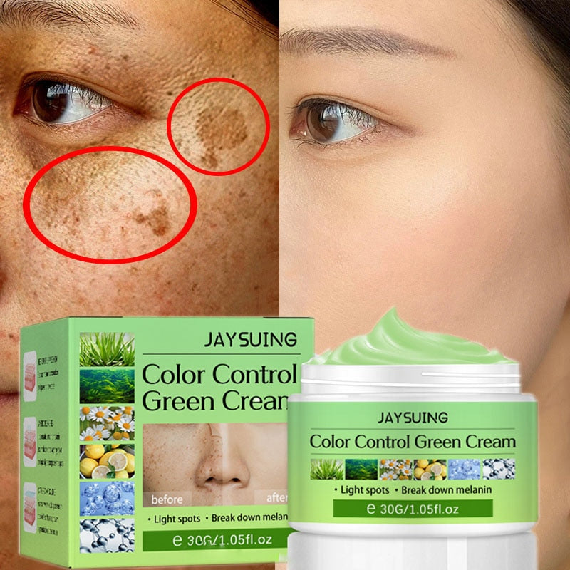 Whitening Freckles, Melasma, Dark Spot, Anti-aging Face Care