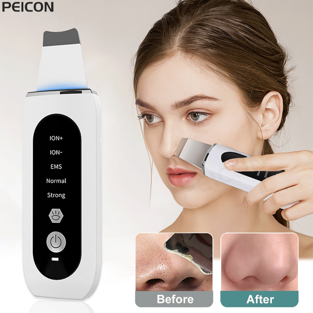 Ultrasonic Skin Scrubber Peeling Blackhead Remover