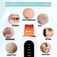 Ultrasonic Skin Scrubber Peeling Blackhead Remover