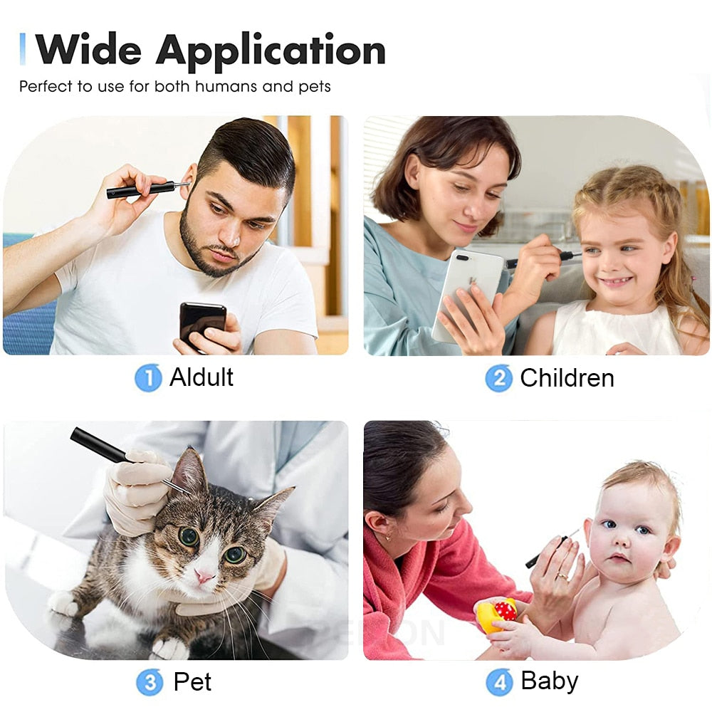 Ear Wax Removal With Camera Otoscope, Wireless WIFI For IOS Apple